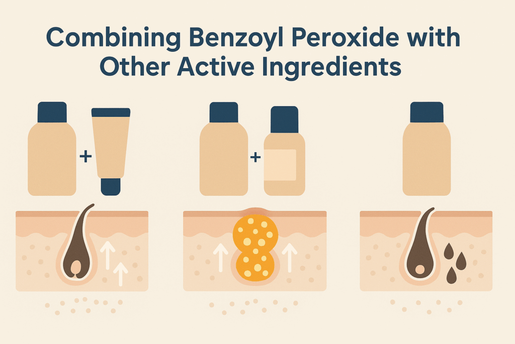Clean infographic showing benzoyl peroxide before and after combinations with adapalene, clindamycin, and solo use, visualizing acne treatment effects on skin.